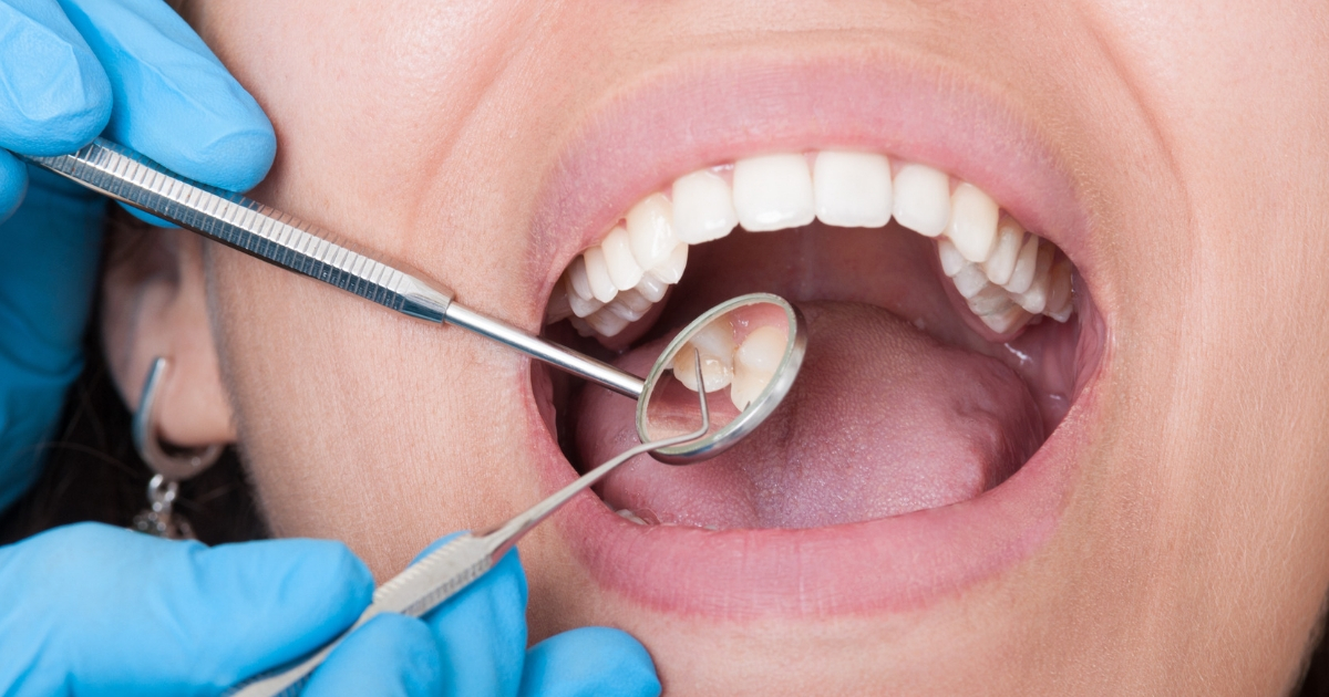 The Shocking Truth About Dental Health: What Dentists Never Share